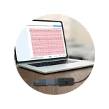 Viatom Szív EKG egészségmonitor - ER1