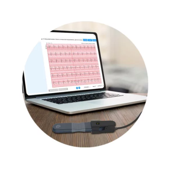 Viatom Szív EKG egészségmonitor - ER1